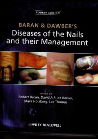 Image of Diseases  Of The Nails and their Management