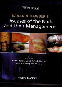 Diseases  Of The Nails and their Management