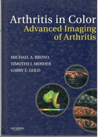 Arthritis in Color Advanced Imaging of Arthritis