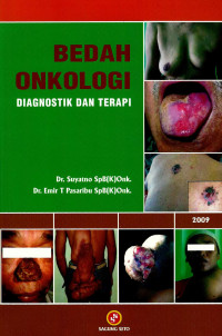 Image of Bedah Onkologi: diagnostik dan terapi