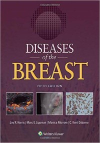 Image of Diseases of The Breast