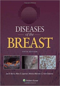 Diseases of The Breast