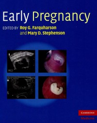 Early Pregnancy