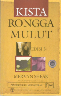 Image of Kista Rongga Mulut