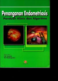 Penanganan Endometrotriosis: panduan klinis dan algoritme