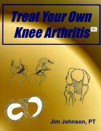 Image of Treat your own knee arthritis