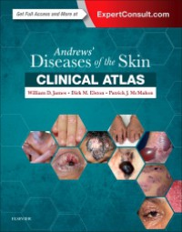 Andrew's Diseases of the Skin : Clinical Atlas