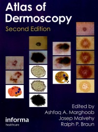 Image of Atlas of dermoscopy