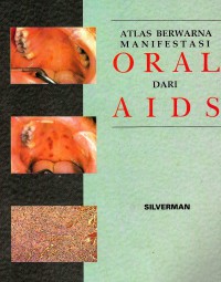Image of Atlas berwarna manifestasi oral dari AIDS