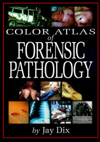 Image of Color atlas of forensic pathology