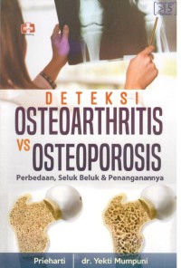 Deteksi Osteoarthritis VS Osteoporosis  : Perbedaan, Seluk Beluk & Penanganan nya