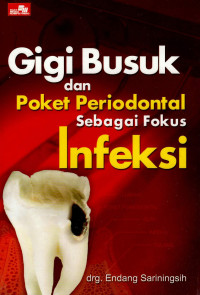Image of Gigi busuk dan poket periodental sebagai fokus infeksi