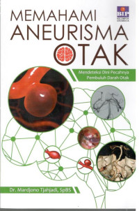 Image of Memahami Aneurisma Otak: Mendeteksi Dini Pecahnya Pembuluh Darah Otak